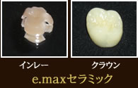 e.maxセラミック